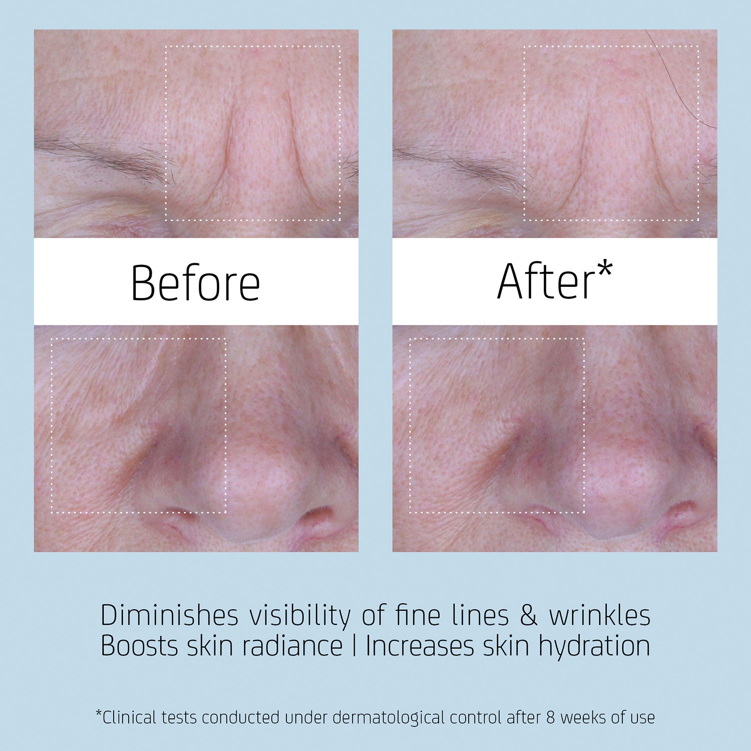 before and after image showing the appearance of skin after using BL+ The Serum